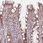 MOZ Antibody in Immunohistochemistry (IHC)