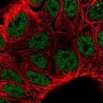 KLF3 Antibody in Immunocytochemistry (ICC/IF)