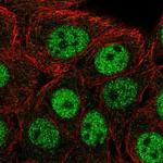 CPSF1 Polyclonal Antibody