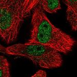 OSTC Antibody in Immunocytochemistry (ICC/IF)