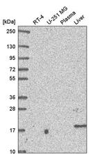 OSTC Antibody in Western Blot (WB)