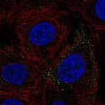 Kindlin 3 Polyclonal Antibody