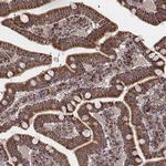 ZDHHC21 Antibody in Immunohistochemistry (Paraffin) (IHC (P))