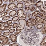ZDHHC21 Antibody in Immunohistochemistry (Paraffin) (IHC (P))