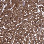 ZDHHC21 Antibody in Immunohistochemistry (Paraffin) (IHC (P))