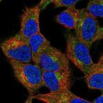 ZDHHC21 Antibody in Immunocytochemistry (ICC/IF)