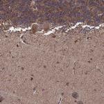 ZDHHC21 Antibody in Immunohistochemistry (IHC)