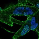ANKRA2 Antibody in Immunocytochemistry (ICC/IF)
