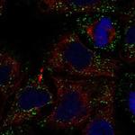 GLTPD2 Polyclonal Antibody