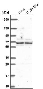 ATAD3A Antibody in Western Blot (WB)
