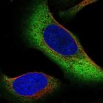 ZNF721 Polyclonal Antibody