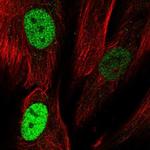 TLE4 Polyclonal Antibody