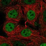 SIVA1 Polyclonal Antibody