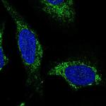 SLC25A44 Polyclonal Antibody