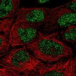 NAALAD2 Polyclonal Antibody