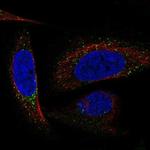 DPT Polyclonal Antibody