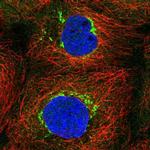 TVP23C Polyclonal Antibody