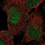 DOC2A Polyclonal Antibody