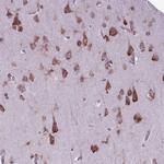 WDR83OS Antibody in Immunohistochemistry (Paraffin) (IHC (P))