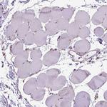 WDR83OS Antibody in Immunohistochemistry (Paraffin) (IHC (P))