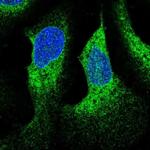 WDR83OS Polyclonal Antibody