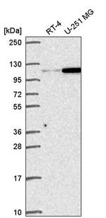 Gemin 4 Antibody in Western Blot (WB)