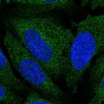 ATL3 Polyclonal Antibody