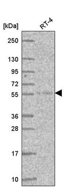 ATL3 Antibody in Western Blot (WB)