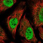 TTC39C Polyclonal Antibody