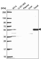 TTC39C Antibody in Western Blot (WB)