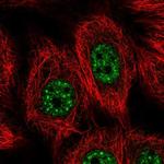 VPS72 Polyclonal Antibody