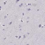 Histone H1T Antibody in Immunohistochemistry (IHC)
