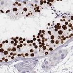 Histone H1T Antibody in Immunohistochemistry (IHC)