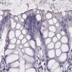 Histone H1T Antibody in Immunohistochemistry (IHC)