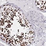 Histone H1T Polyclonal Antibody