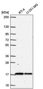 TMEM133 Antibody in Western Blot (WB)