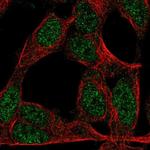 ZNF423 Polyclonal Antibody