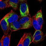 TBC1D16 Polyclonal Antibody