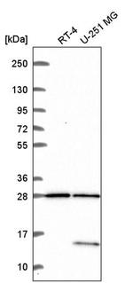 TBC1D16 Antibody in Western Blot (WB)