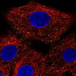 ANKFY1 Polyclonal Antibody