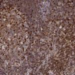 MFSD1 Polyclonal Antibody