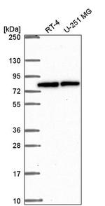 MTG16 Antibody in Western Blot (WB)