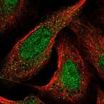 CDKL1 Polyclonal Antibody