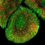 KV2.2 (KCNB2) Polyclonal Antibody