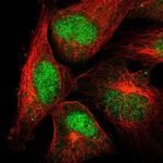 POLM Polyclonal Antibody