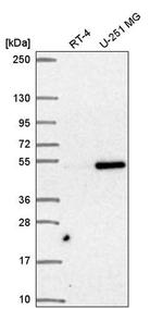 SNAPC3 Antibody in Western Blot (WB)
