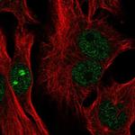 CTC-534A2.2 Antibody in Immunocytochemistry (ICC/IF)