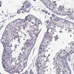 PP2D1 Antibody in Immunohistochemistry (IHC)