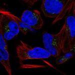 C9orf64 Polyclonal Antibody