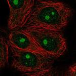 IMP4 Polyclonal Antibody